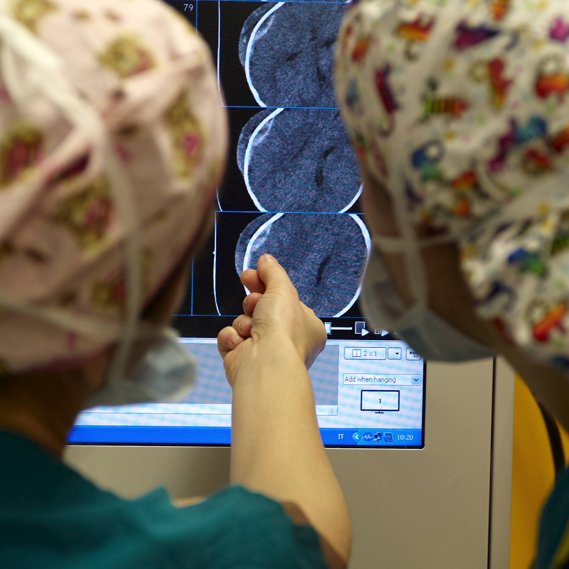 Il robot neurochirurgico arriva all’Ospedale Pediatrico Meyer (Foto di Stefano Lupi)