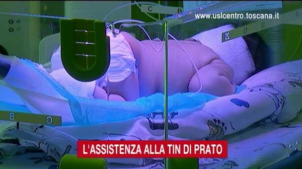 La Terapia Intensiva Neonatale di Prato