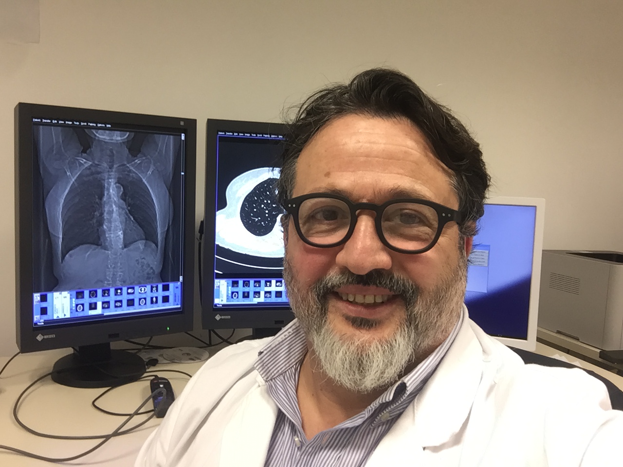 Maurizio Bartolucci direttore Radiologia Ospedale Santo Stefano Prato