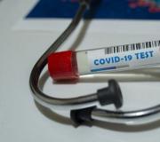 Coronavirus (Foto di repertorio)