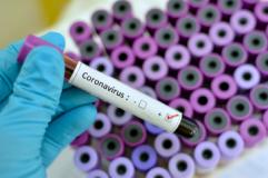 Coronavirus: 90 nuovi casi, 1 decesso, 93 guarigioni